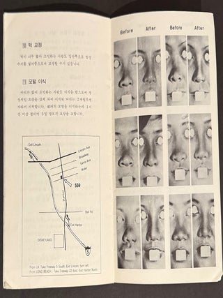 Van Hai Pham, MD. Cosmetic surgery since 1960