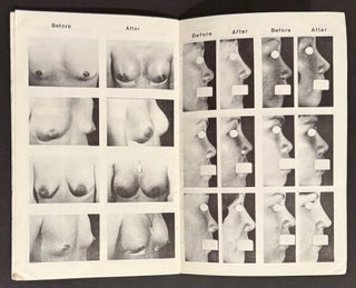 Van Hai Pham, MD. Cosmetic surgery since 1960