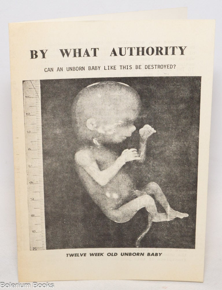 Cat.No: 336517 By what authority can an unborn baby like this be